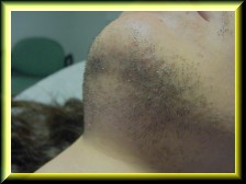 Fotografica antes del tratamiento